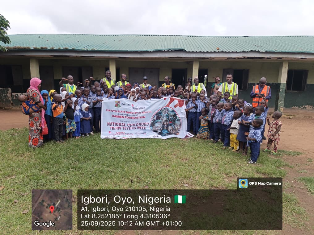 TB Project whatsapp image 2025 11 27 at 9.44.25 am